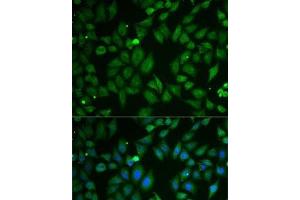 Immunofluorescence analysis of U2OS cells using SCG2 Polyclonal Antibody (SCG2 anticorps)