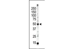 Image no. 1 for anti-Protein Kinase C and Casein Kinase Substrate in Neurons 3 (PACSIN3) (N-Term) antibody (ABIN360557)