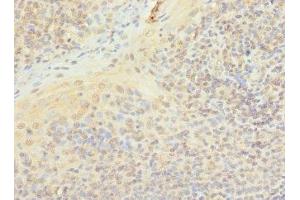 Immunohistochemistry of paraffin-embedded human tonsil tissue using ABIN7163185 at dilution of 1:100 (PIP5K1A anticorps  (AA 293-562))