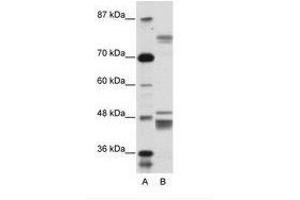 Image no. 1 for anti-Zinc Finger Protein 607 (ZNF607) (AA 312-361) antibody (ABIN6736155) (ZNF607 anticorps  (AA 312-361))