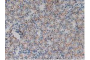 Figure. (ITGAD anticorps  (AA 879-1099))