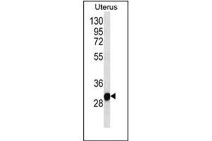Western blot analysis of RNF148 Antibody (C-term) in Human normal Uterus cell line lysates (35ug/lane).