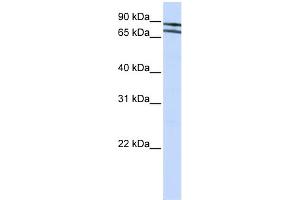 WB Suggested Anti-ZNF572 Antibody Titration:  0. (ZNF572 anticorps  (N-Term))