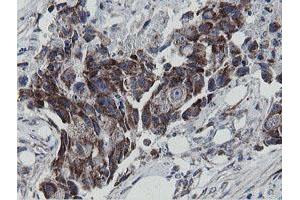 Image no. 5 for anti-Mitochondrial Ribosomal Protein S27 (MRPS27) (AA 151-414) antibody (ABIN1490969)