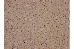 IHC image of ABIN7140118 diluted at 1:100 and staining in paraffin-embedded human adrenal gland tissue performed on a Leica BondTM system. (RHBDD3 anticorps  (AA 304-323))