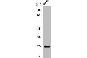 Western Blot analysis of COLO205 cells using Rab L2A Polyclonal Antibody (RABL2A anticorps  (C-Term))