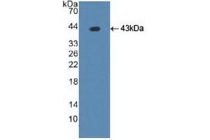 Detection of Recombinant ATP7b, Human using Polyclonal Antibody to ATPase, Cu++ Transporting Beta Polypeptide (ATP7b) (ATP7B anticorps  (AA 59-426))