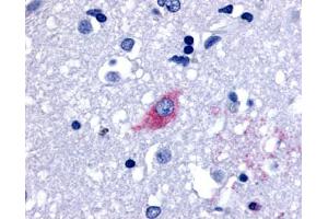 Anti-LGR4 antibody IHC of human brain, neurons and glia. (LGR4 anticorps  (Cytoplasmic Domain))