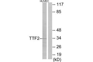 Western blot analysis of extracts from HUVEC cells, using TTF2 antibody. (TTF2 anticorps  (N-Term))