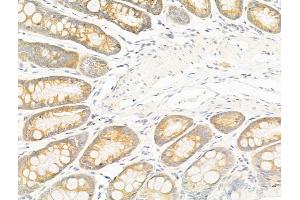 ABIN6258423 and ABIN6276238 at 1/100 staining Rat colorectal tissue by IHC-P. (GIPR anticorps  (Internal Region))