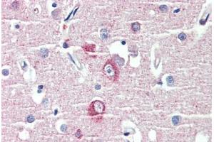 Brain, cortex, Human: Formalin-Fixed, Paraffin-Embedded (FFPE) (DLGAP1 anticorps  (AA 391-405))