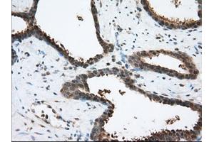 Immunohistochemistry (IHC) image for anti-Acetyl-CoA Acetyltransferase 2 (ACAT2) antibody (ABIN1496400) (ACAT2 anticorps)