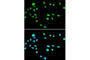 Immunofluorescence analysis of A549 cells using RUVBL1 antibody. (RUVBL1 anticorps  (AA 1-240))
