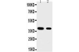 Anti-KLF5 antibody, Western blotting Lane 1: HELA Cell Lysate Lane 2: MCF-7 Cell Lysate