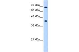 Western Blotting (WB) image for anti-Carbohydrate (N-Acetylgalactosamine 4-0) Sulfotransferase 8 (CHST8) antibody (ABIN2463289) (CHST8 anticorps)
