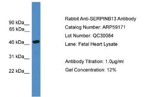 WB Suggested Anti-SERPINB13  Antibody Titration: 0. (SERPINB13 anticorps  (Middle Region))