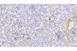 Detection of BACE2 in Mouse Kidney Tissue using Polyclonal Antibody to Beta Secretase 2 (BACE2)