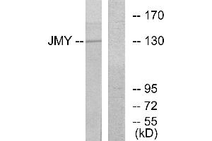 Western blot analysis of extracts from COLO cells, using JMY antibody. (JMY anticorps  (Internal Region))