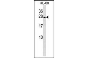 Western blot analysis of PGRMC2 Antibody (C-term) in HL-60 cell line lysates (35ug/lane).
