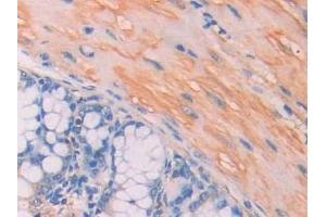 Detection of CA7 in Mouse Colon Tissue using Polyclonal Antibody to Carbonic Anhydrase VII (CA7)