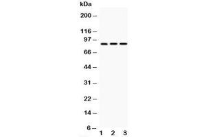 Western blot testing of CD18 antibody and Lane 1:  HeLa;  2: Jurkat;  3: HT1080;  Predicted/Observed size: 85~95KD depending on glycosylation level (Integrin beta 2 anticorps  (N-Term))