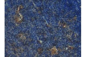 Detection of S100 in Mouse Lymph node Tissue using Polyclonal Antibody to S100 Calcium Binding Protein (S100)