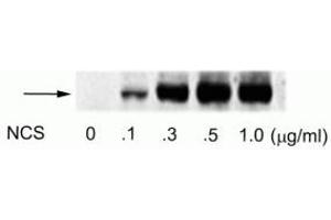 Western blot of human melanoma cells incubated with varying doses of the radiomimetic drug NCS showing specific immunolabeling of the ~74 kDa ATF2 protein phosphorylated at Ser490 and Ser498. (ATF2 anticorps  (pSer490, pSer498))