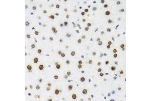 Immunohistochemistry of paraffin-embedded mouse liver using H2AFX antibody. (H2AFX anticorps)