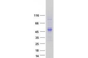 Validation with Western Blot