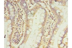 Immunohistochemistry of paraffin-embedded human small intestine tissue using ABIN7165992 at dilution of 1:100