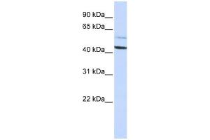 WB Suggested Anti-PSMD4 Antibody Titration: 0. (PSMD4/ASF anticorps  (N-Term))