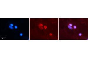 Rabbit Anti-NR1I2 Antibody    Formalin Fixed Paraffin Embedded Tissue: Human Adult heart  Observed Staining: Nuclei in adipocytes but not in cardiomyocytes Primary Antibody Concentration: 1:100 Secondary Antibody: Donkey anti-Rabbit-Cy2/3 Secondary Antibody Concentration: 1:200 Magnification: 20X Exposure Time: 0. (NR1I2 anticorps  (N-Term))