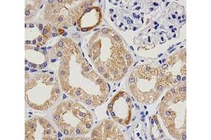 Immunohistochemical analysis of paraffin-embedded human kidney using vWF at 1:25 dilution.