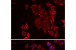 Immunofluorescence analysis of U2OS cells using PAICS Polyclonal Antibody (PAICS anticorps)