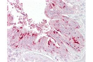 Anti-EIF4E antibody IHC of human lung, respiratory epithelium.