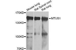 Western blot analysis of extracts of various cell lines, using MTUS1 antibody. (MTUS1 anticorps)