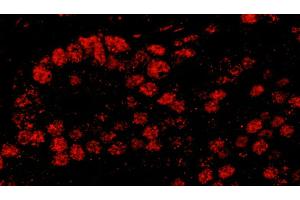 anti-PDS5, Regulator of Cohesion Maintenance, Homolog B (PDS5B) (AA 1200-1250) antibody