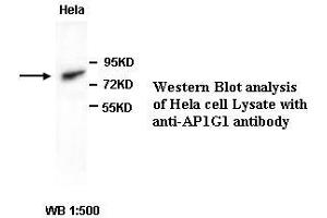Image no. 1 for anti-Adaptor-Related Protein Complex 1, gamma 1 Subunit (AP1G1) antibody (ABIN791086)