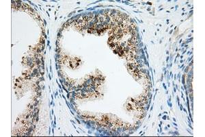 Immunohistochemical staining of paraffin-embedded Human Kidney tissue using anti-RAB17 mouse monoclonal antibody. (RAB17 anticorps)