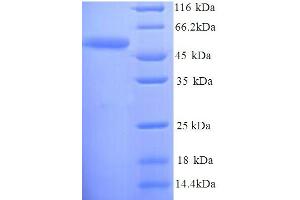 SDS-PAGE (SDS) image for Succinate Dehydrogenase Complex, Subunit D, Integral Membrane Protein (SDHD) (AA 1-440), (full length) protein (His tag) (ABIN5714266)