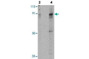 Western blot analysis of PAK7 in T24 lysate with PAK7 polyclonal antibody  at 2 and 4 ug/mL . (PAK7 anticorps  (Internal Region))