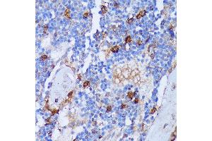 Immunohistochemistry of paraffin-embedded Rat bone marrow using P antibody (ABIN7269207) at dilution of 1:100 (40x lens). (PAD4 anticorps  (AA 374-550))