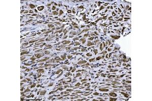 IHC analysis of ERLIN2 using anti-ERLIN2 antibody (ABIN7602582). (ERLIN2 anticorps  (AA 87-339))