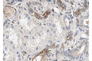 ABIN6279570 at 1/100 staining Human kidney tissue by IHC-P.