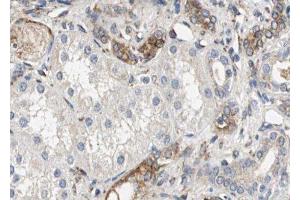 ABIN6279570 at 1/100 staining Human kidney tissue by IHC-P. (NNT anticorps  (C-Term))