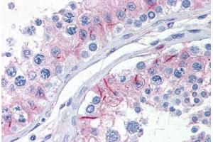 Human Testis: Formalin-Fixed, Paraffin-Embedded (FFPE) (ZYX anticorps  (AA 1-573))