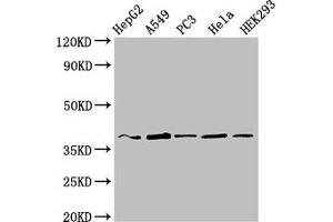 Western Blot Positive WB detected in: HepG2 whole cell lysate, A549 whole cell lysate, PC-3 whole cell lysate, Hela whole cell lysate, HEK293 whole cell lysate All lanes: CRK antibody at 3 μg/mL Secondary Goat polyclonal to rabbit IgG at 1/50000 dilution Predicted band size: 34, 23 kDa Observed band size: 37 kDa (Crk anticorps  (AA 40-196))