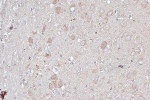 Immunohistochemistry of paraffin-embedded rat brain using MAP1LC3B antibody. (LC3B anticorps)