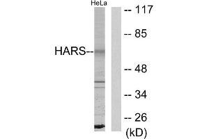Western blot analysis of extracts from HeLa cells, using HARS antibody. (HARS1/Jo-1 anticorps  (C-Term))