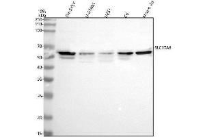 Western blot analysis of VGLUT2/SLC17A6 using anti-VGLUT2/SLC17A6 antibody (ABIN7599482).